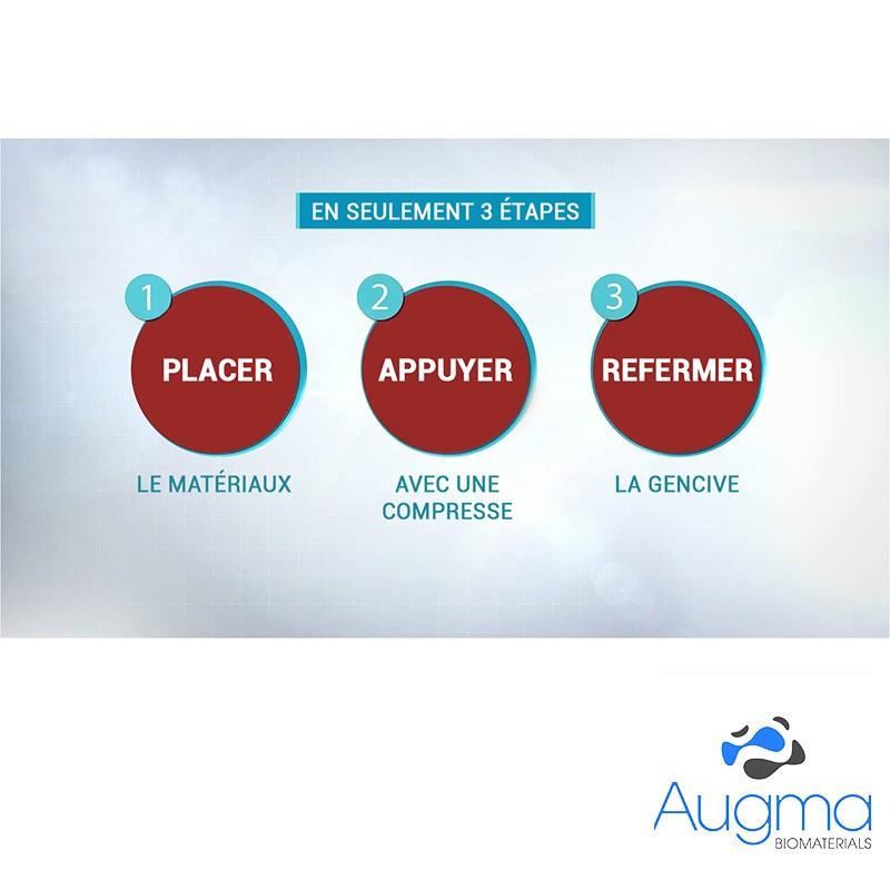 a4ade5d569c972bb41d07f7560985cde-1 boite 6x Bond Apatite™ comblement osseux instantané par Augma Biomaterials™ - Safe Implant