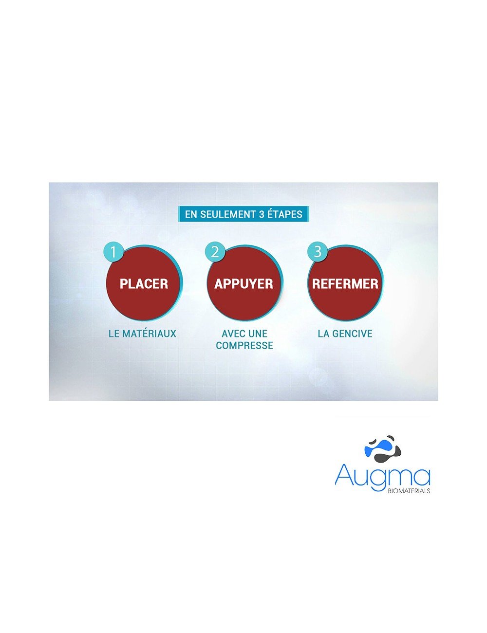 e38f8f2f91d933060a88a6e67d0e6b6b-1 Pack Bond Apatite™, Matbeka™ et fils de suture - Safe Implant