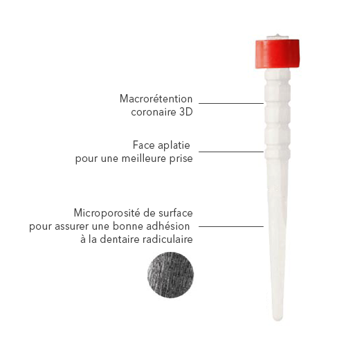 relyx-fiber-post-3D-1