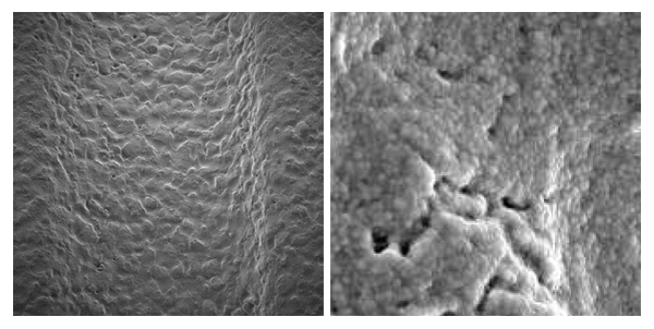 surfacezircone-1 Implant zircone 2 pièces de Tav Dental diamètre 4.1 - Safe Implant